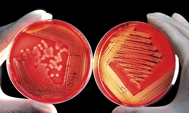 Jak pozbyć się kleju na gorąco?